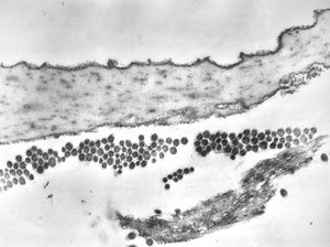 F,39y. | collagen, elastin and oxytalan microfibrils F,39y. | collagen, elastin and oxytalan microfibrils